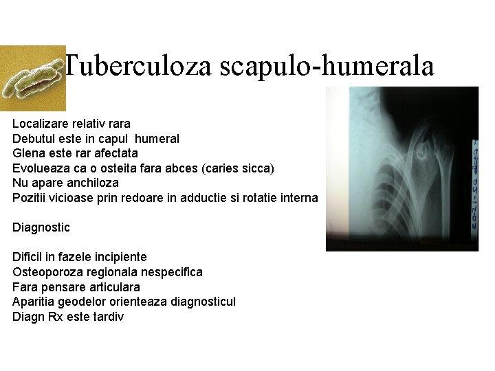 Tuberculoza scapulo-humerala Localizare relativ rara Debutul este in capul humeral Glena este rar afectata