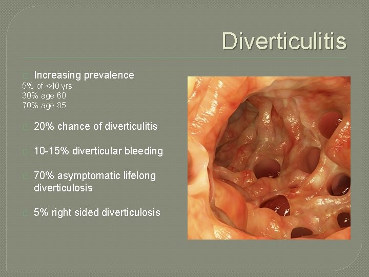 Diverticulitis � Increasing prevalence 5% of <40 yrs 30% age 60 70% age 85