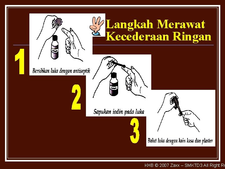 Langkah Merawat Kecederaan Ringan KHB © 2007 Zaxx – SMKTD 3 All Right Re