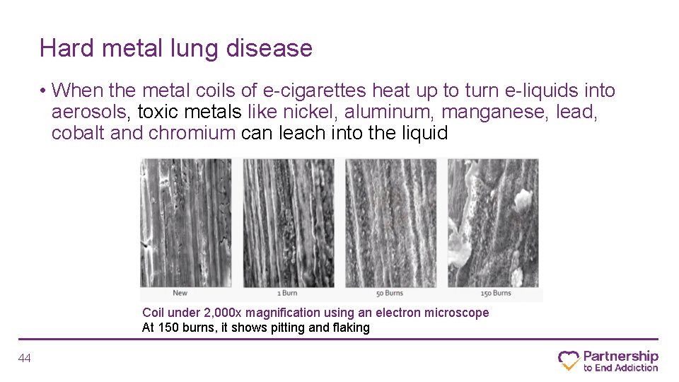 Hard metal lung disease • When the metal coils of e-cigarettes heat up to