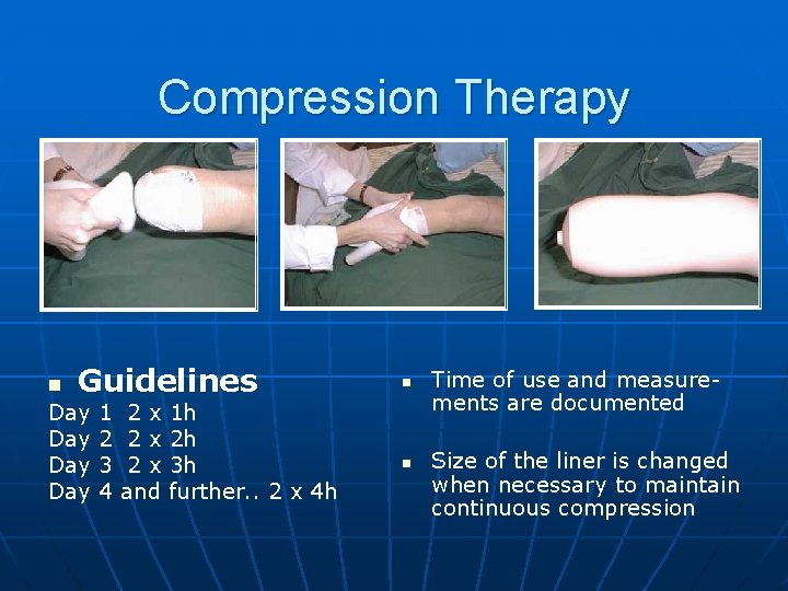 Compression Therapy n Guidelines Day Day 1 2 3 4 2 x 1 h