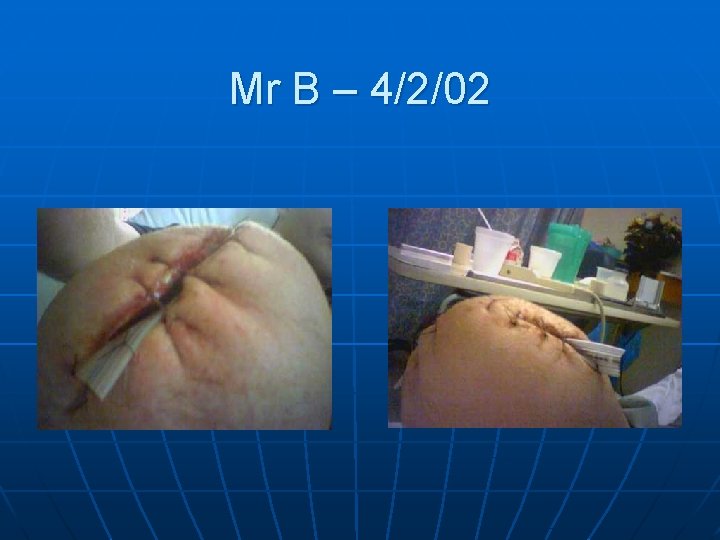 Mr B – 4/2/02 