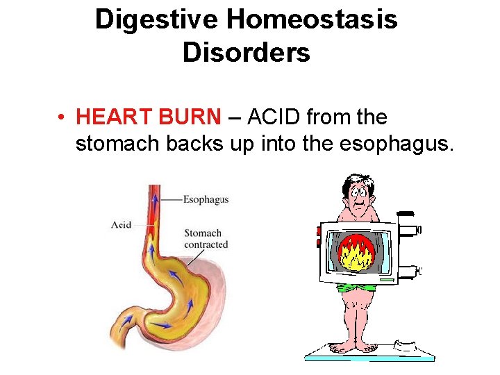 Digestive Homeostasis Disorders • HEART BURN – ACID from the stomach backs up into