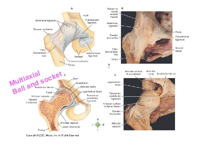 l t a i e x k a c lti d so u M