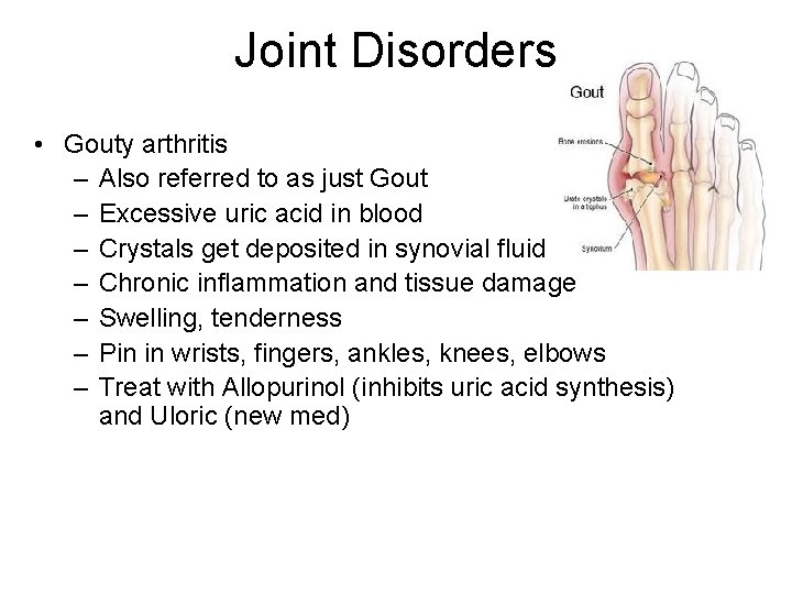 Joint Disorders • Gouty arthritis – Also referred to as just Gout – Excessive