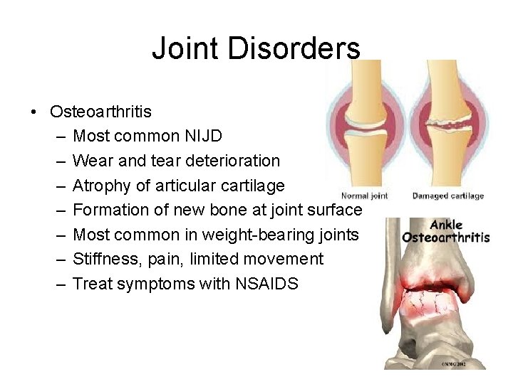 Joint Disorders • Osteoarthritis – Most common NIJD – Wear and tear deterioration –