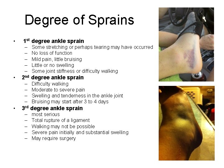 Degree of Sprains • 1 st degree ankle sprain – – – • 2