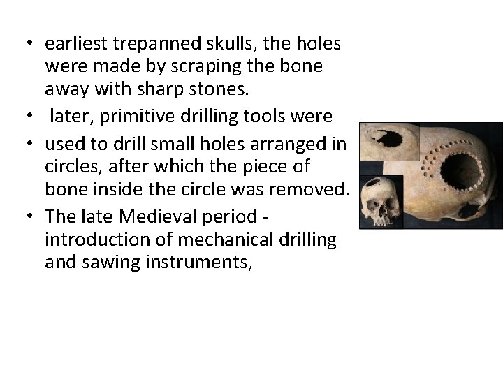  • earliest trepanned skulls, the holes were made by scraping the bone away