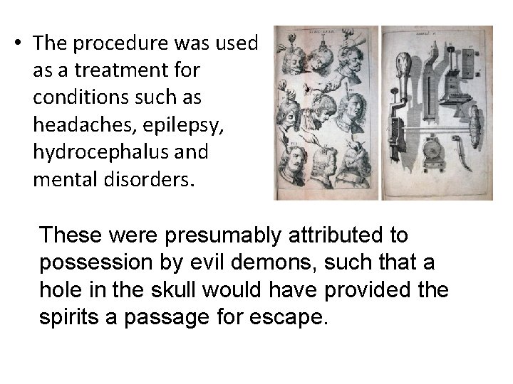  • The procedure was used as a treatment for conditions such as headaches,