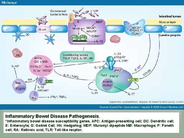 Inflammatory Bowel Disease Pathogenesis. *Inflammatory bowel disease susceptibility genes. APC: Antigen-presenting cell; DC: Dendritic