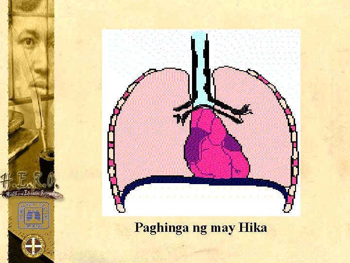 Paghinga ng may Hika 