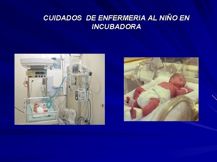 CUIDADOS DE ENFERMERIA AL NIÑO EN INCUBADORA 