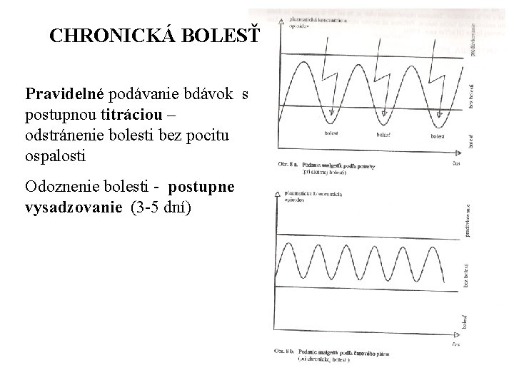 CHRONICKÁ BOLESŤ Pravidelné podávanie bdávok s postupnou titráciou – odstránenie bolesti bez pocitu ospalosti