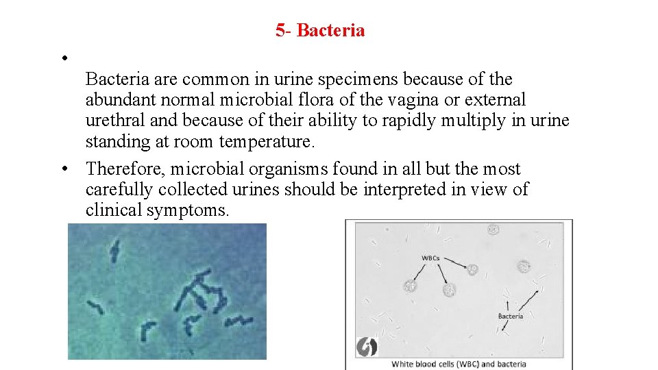 5 - Bacteria • Bacteria are common in urine specimens because of the abundant