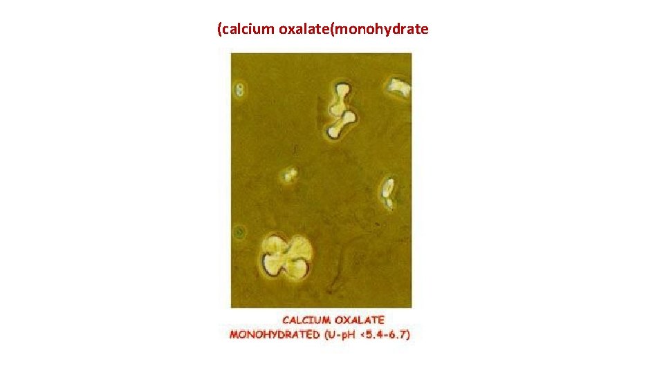 (calcium oxalate(monohydrate 