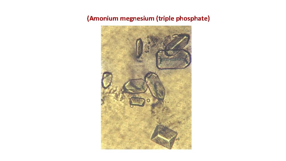 (Amonium megnesium (triple phosphate) 