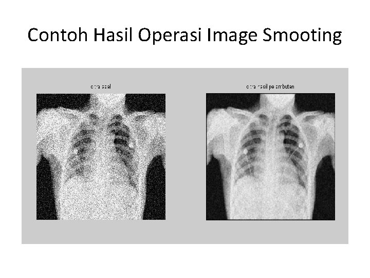 Contoh Hasil Operasi Image Smooting 