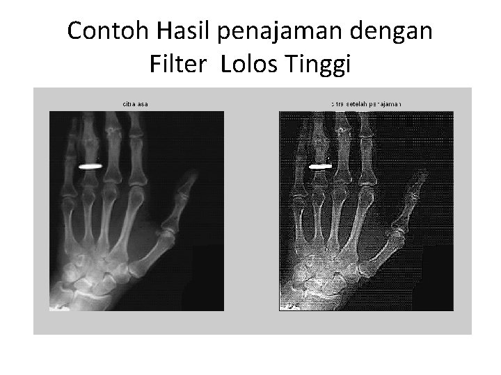 Contoh Hasil penajaman dengan Filter Lolos Tinggi 