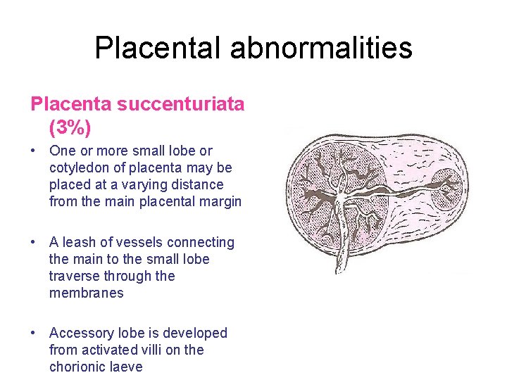 Placental abnormalities Placenta succenturiata (3%) • One or more small lobe or cotyledon of Placental abnormalities Placenta succenturiata (3%) • One or more small lobe or cotyledon of