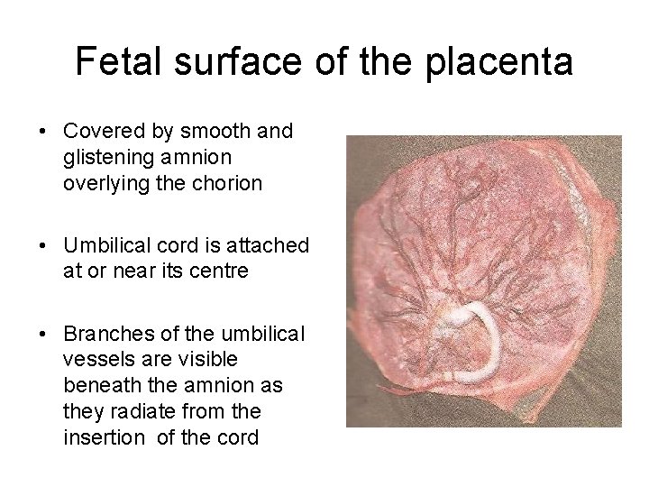 Fetal surface of the placenta • Covered by smooth and glistening amnion overlying the Fetal surface of the placenta • Covered by smooth and glistening amnion overlying the