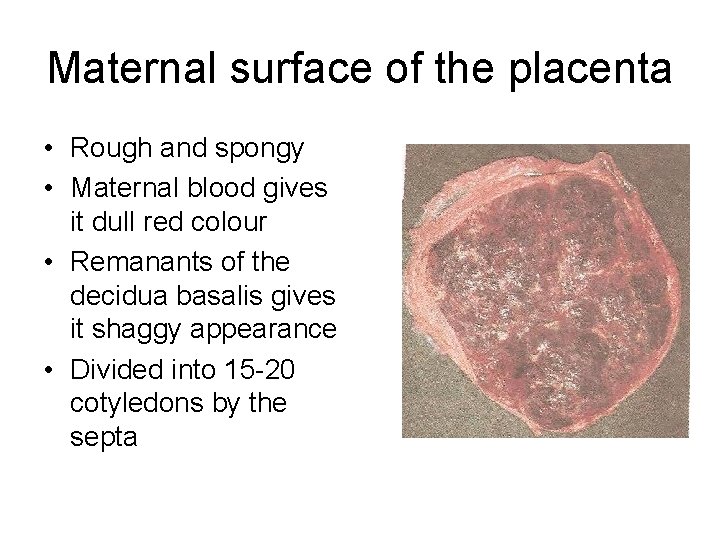 Maternal surface of the placenta • Rough and spongy • Maternal blood gives it Maternal surface of the placenta • Rough and spongy • Maternal blood gives it