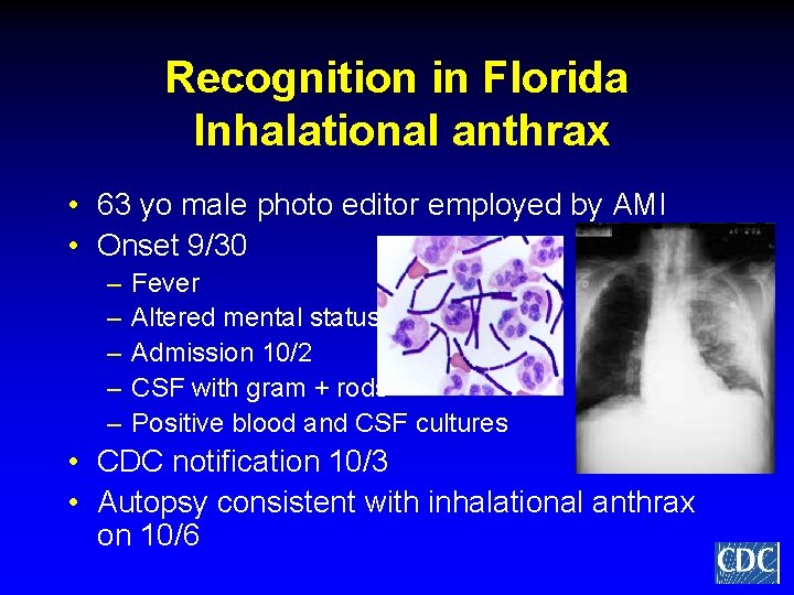 Recognition in Florida Inhalational anthrax • 63 yo male photo editor employed by AMI