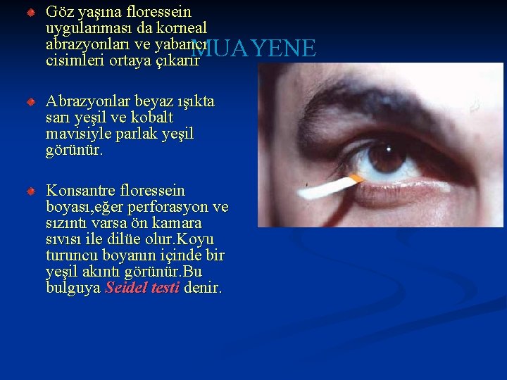 Göz yaşına floressein uygulanması da korneal abrazyonları ve yabancı MUAYENE cisimleri ortaya çıkarır Abrazyonlar