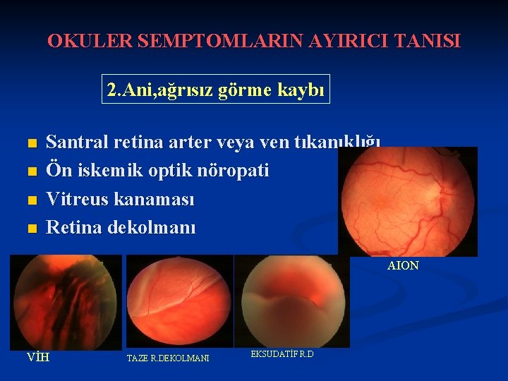 OKULER SEMPTOMLARIN AYIRICI TANISI 2. Ani, ağrısız görme kaybı n n Santral retina arter