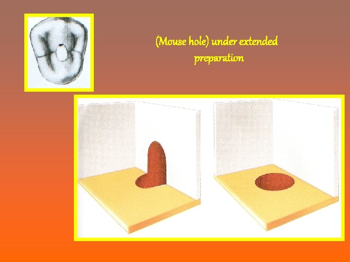 (Mouse hole) under extended preparation 