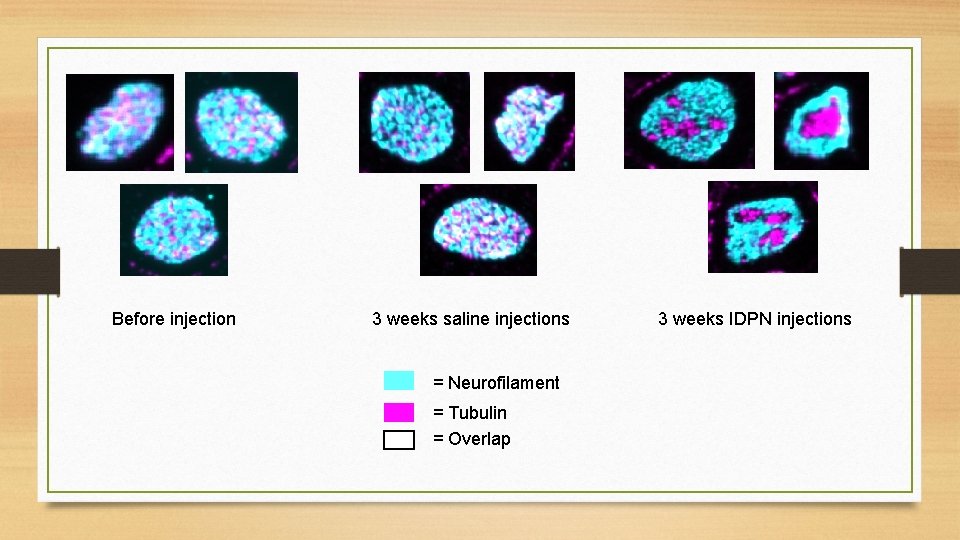 Before injection 3 weeks saline injections = Neurofilament = Tubulin = Overlap 3 weeks