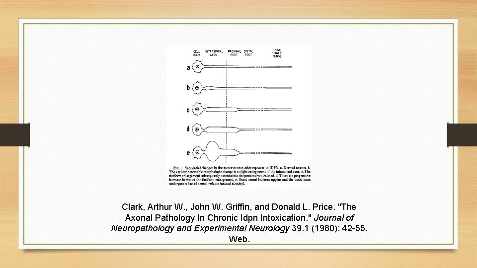 Clark, Arthur W. , John W. Griffin, and Donald L. Price. "The Axonal Pathology