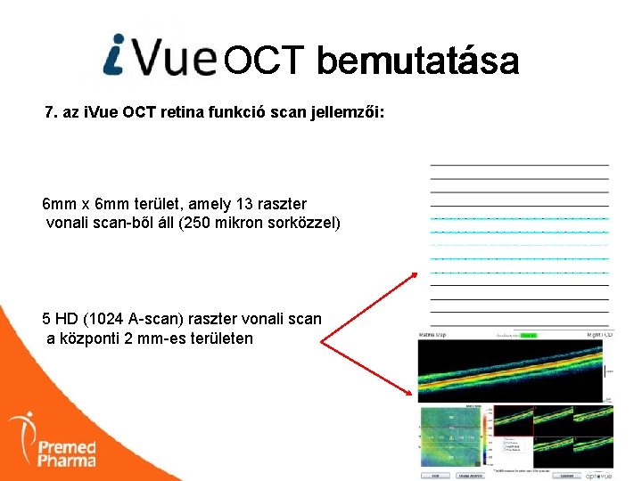 i. VUE OCT bemutatása 7. az i. Vue OCT retina funkció scan jellemzői: 6