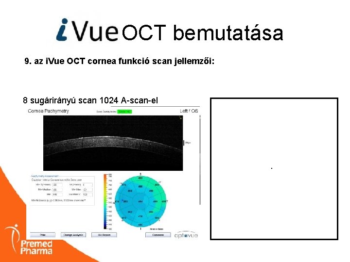 OCT bemutatása 9. az i. Vue OCT cornea funkció scan jellemzői: 8 sugárirányú scan