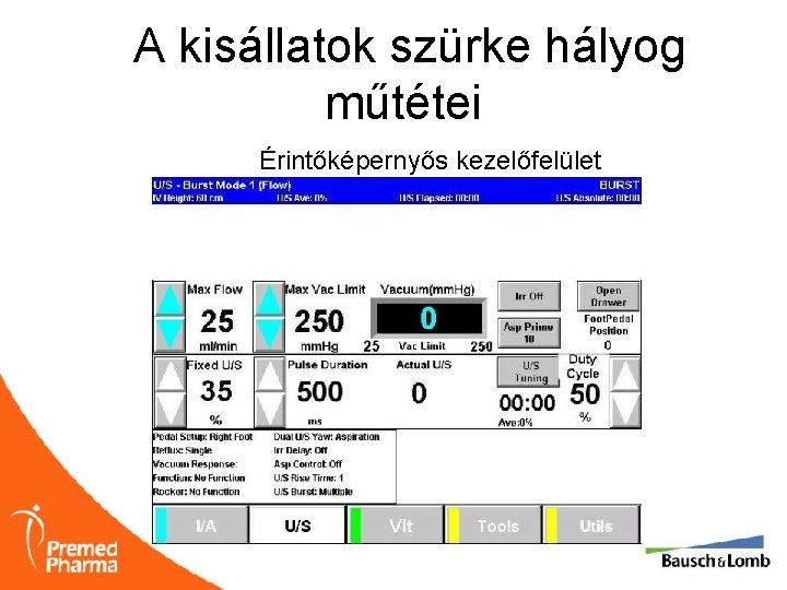 A kisállatok szürke hályog műtétei Érintőképernyős kezelőfelület 