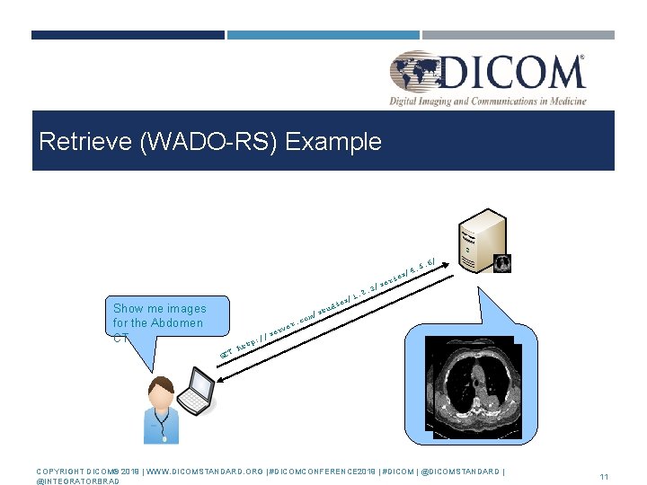 Retrieve (WADO-RS) Example / 5. 6 1 es/ Show me images for the Abdomen