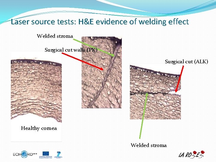 Laser source tests: H&E evidence of welding effect Welded stroma Surgical cut walls (PK)