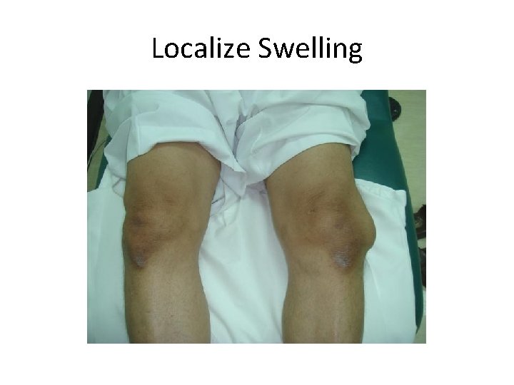 Localize Swelling 