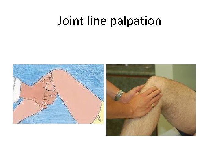 Joint line palpation 