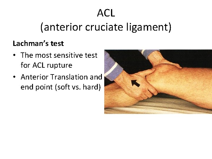 ACL (anterior cruciate ligament) Lachman’s test • The most sensitive test for ACL rupture