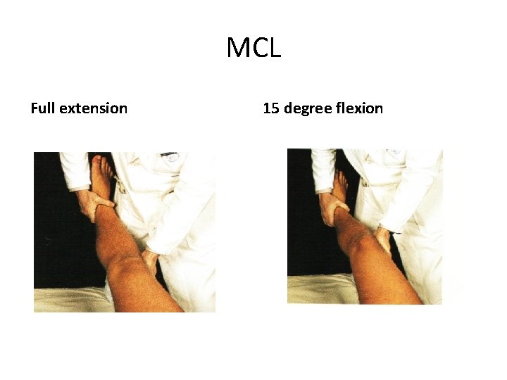 MCL Full extension 15 degree flexion 