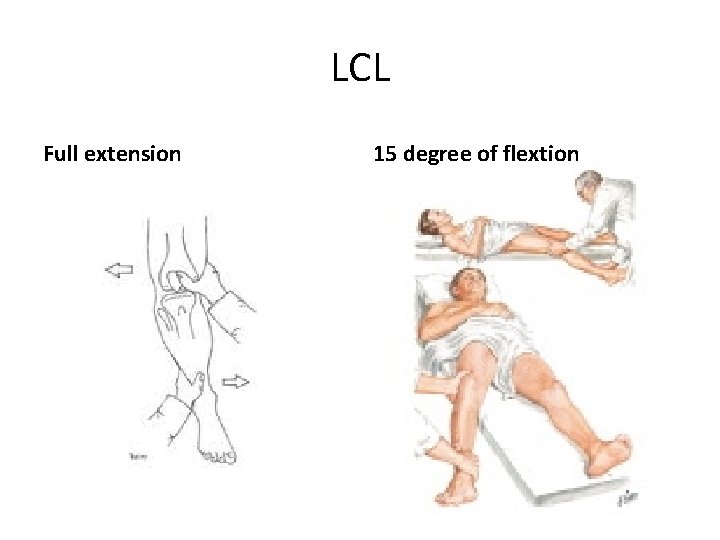 LCL Full extension 15 degree of flextion 