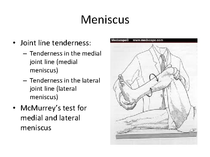 Meniscus • Joint line tenderness: – Tenderness in the medial joint line (medial meniscus)
