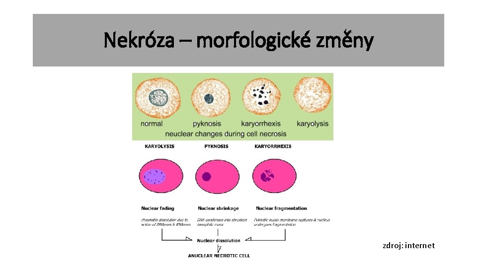 Nekróza – morfologické změny zdroj: internet 