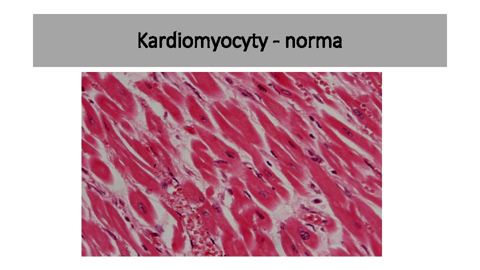 Kardiomyocyty - norma 