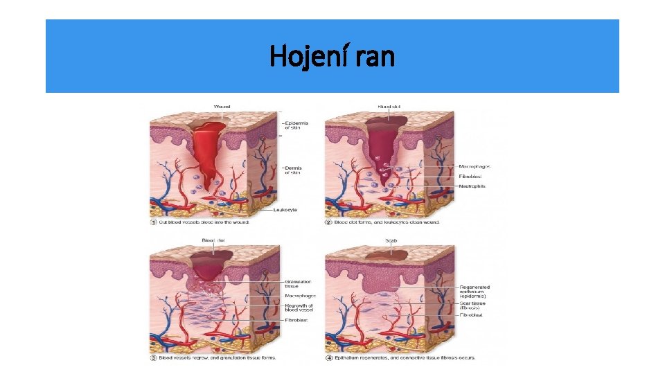Hojení ran 