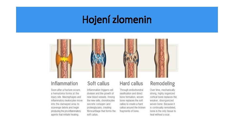 Hojení zlomenin 