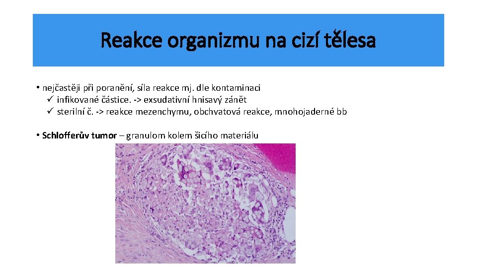 Reakce organizmu na cizí tělesa • nejčastěji při poranění, síla reakce mj. dle kontaminaci