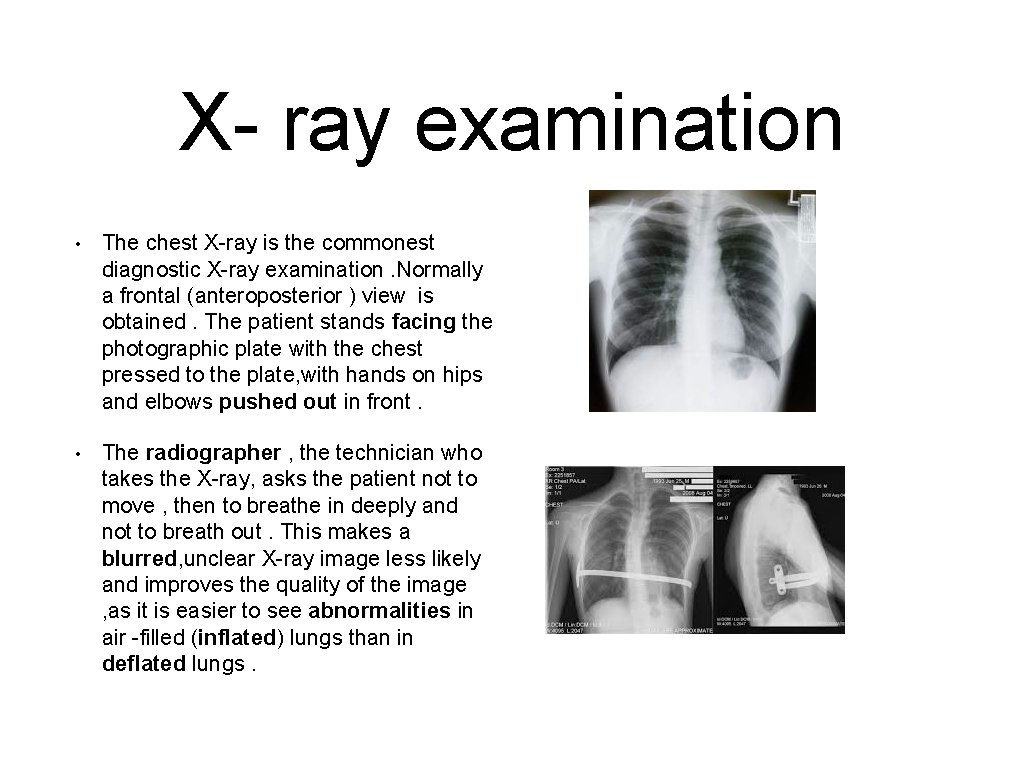 X- ray examination • The chest X-ray is the commonest diagnostic X-ray examination. Normally