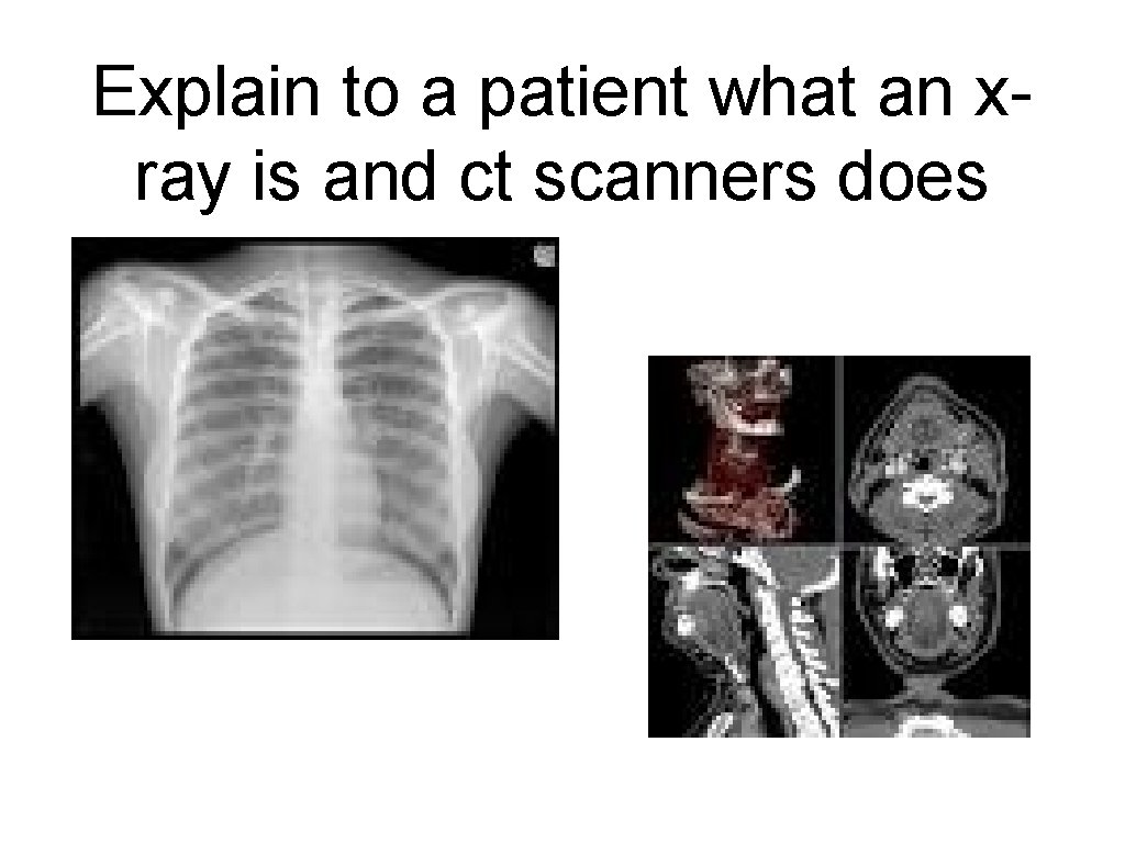 Explain to a patient what an xray is and ct scanners does 