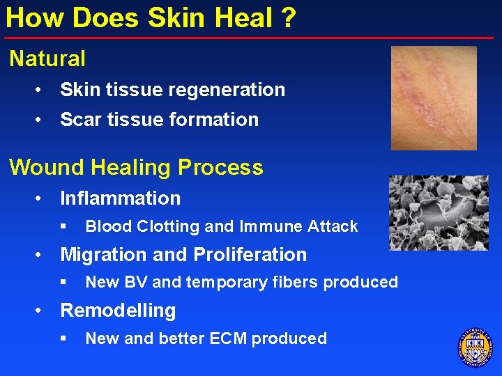 How Does Skin Heal ? Natural • Skin tissue regeneration • Scar tissue formation